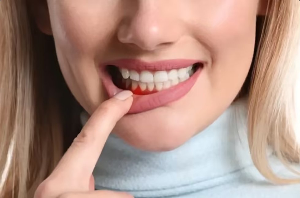 Periodontics (gum treatment)