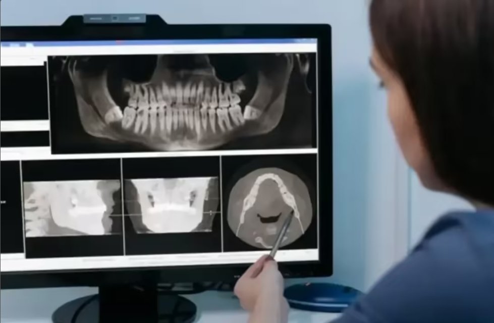 X-Ray